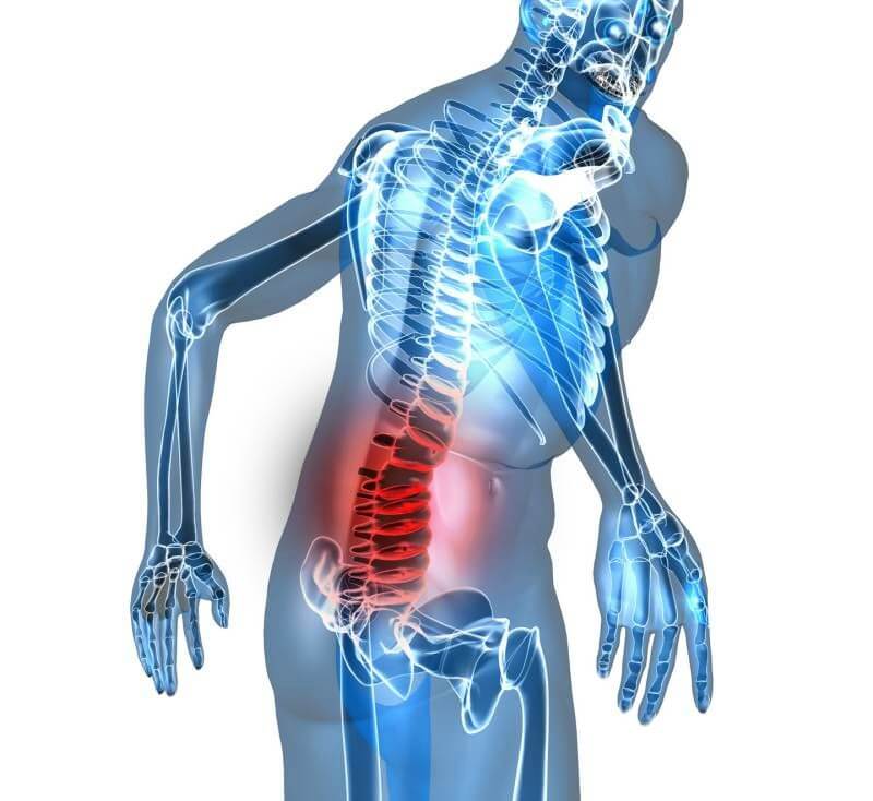 Rhumatismes : Arthrose lombaire