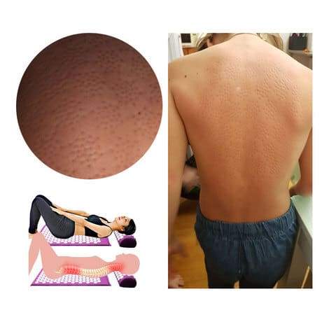 Tapis d'acupression fleur de lotus anti douleurs et résultat sur une femme qui a des douleurs lombaires et cervicales