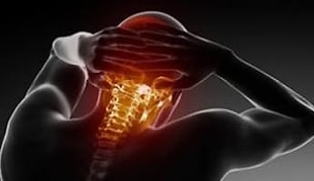 Arthrose cervicale au niveau du cou d'un homme